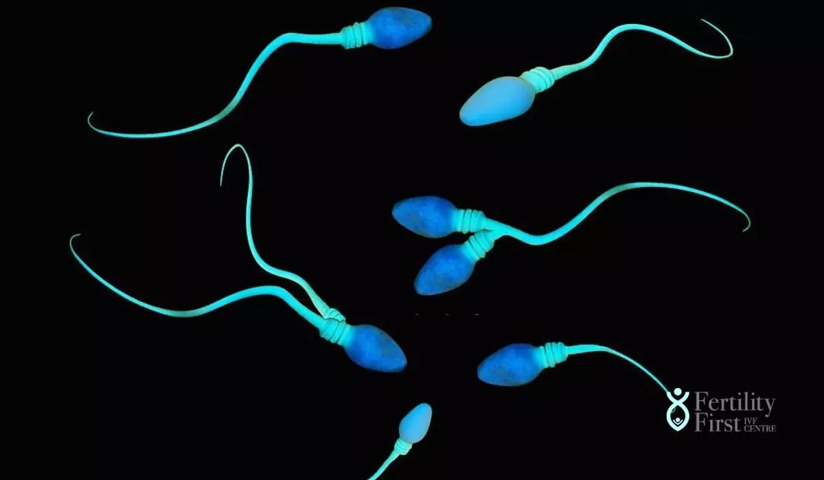 Sperm morphology