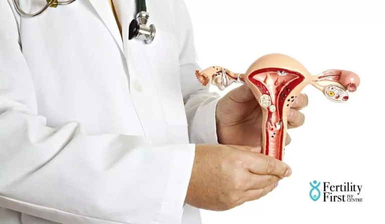 Uterine Fibroids And Infertility